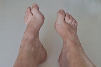 How High Arches Affect Foot Health